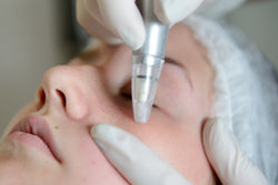 Dermabrasion and Microdermabrasion – the Effects and Results of Treatments